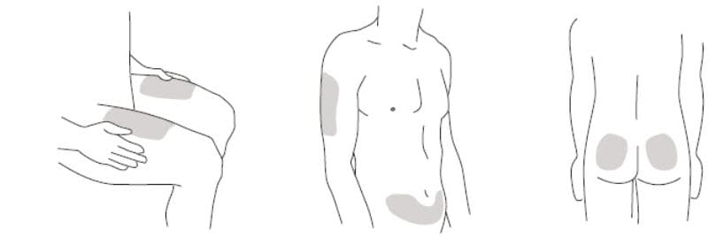 Step 2: Prepare your injection site  Choose an injection site around your stomach area (abdomen), buttocks, upper legs (thighs). If a caregiver is giving you the injection, the outer area of the upper arms may also be used. Use a different injection site for each injection. Do not give an injection in an area of the skin that is tender, bruised, red or hard. Clean the skin with an antiseptic wipe where you plan to give your injection. Do not touch this area again before giving the injection. Let your skin dry before injecting. Do not fan or blow on the clean area. image