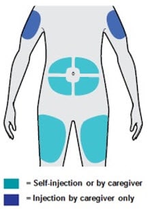 Choose your injection site. You can inject into your thigh or stomach, except for the 2 inches around your belly button. If someone else is injecting it into you they can also administer the injection into the outer upper arm.