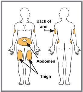 Choose your injection site.   You may inject in your stomach area (abdomen) or in your thigh, or in the back of your arm. To inject in your arm, you will need someone to help you. Do not give an injection into areas where the skin is tender, bruised, red or hard, or in an area of skin that is affected by psoriasis. Do not inject within 1 inch of the navel (belly button). Alternate your injection sites.image