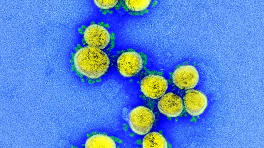 Novel coronavirus SARS-CoV-2