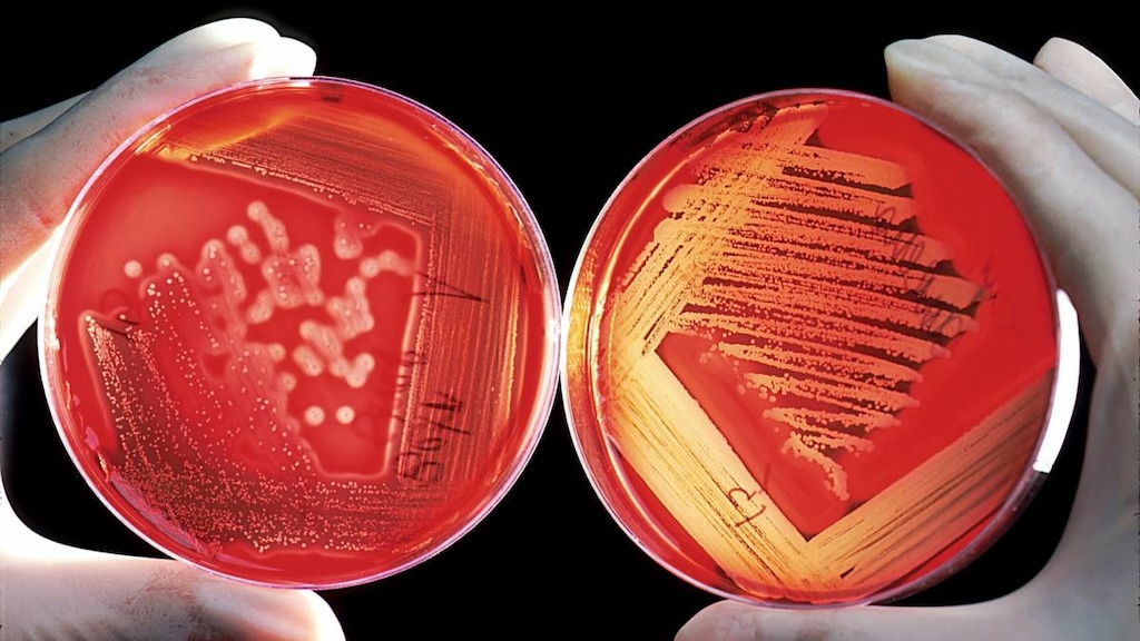 Bacteria in petri dish