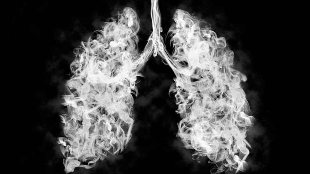 COPD lungs and flare-ups