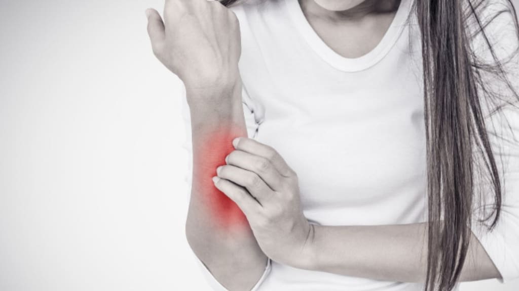 Understand the difference between eczema and psoriasis