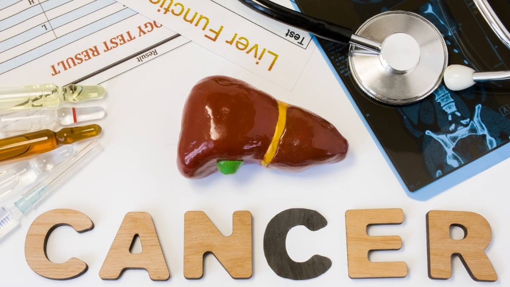 Liver Cancer