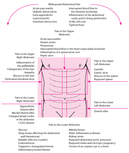 Causes of Abdominal Pain by Location