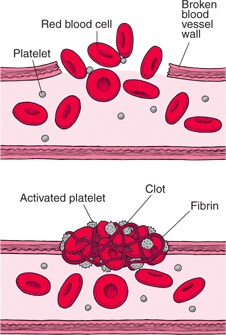 Blood Clots: Plugging the Breaks