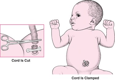 Cutting the Umbilical Cord