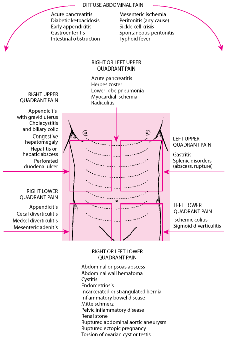 Location of abdominal pain and possible causes
