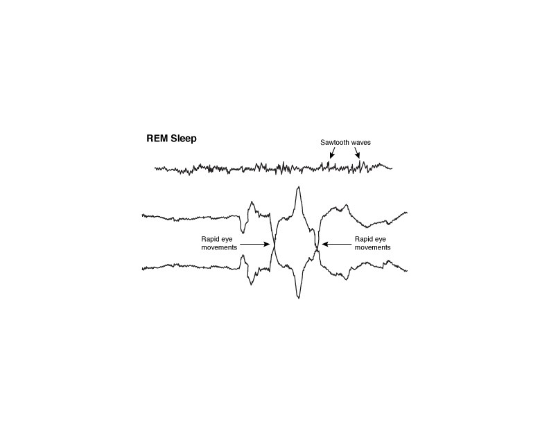 Rapid eye movement (REM) EEG