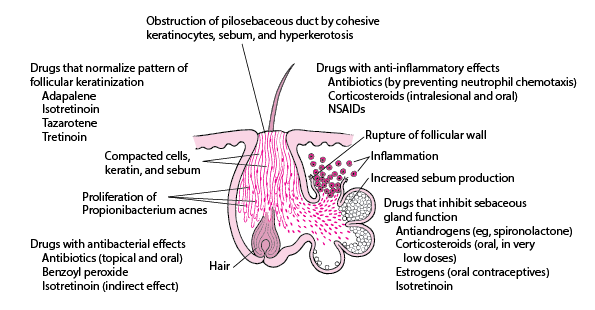 How various drugs work in treating acne