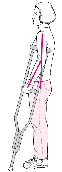 Fitting crutches